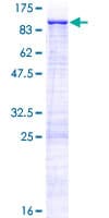 Human ZNF182 / ZNF21 Protein (Recombinant GST)