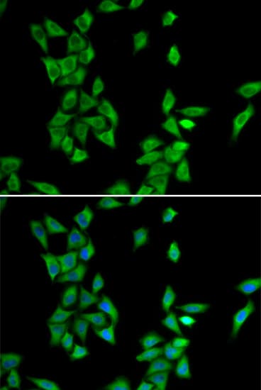 IHC-plus™ ANXA4 / Annexin IV Antibody