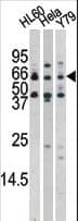 Polyclonal Rabbit anti-Human RAD9A / RAD9 Antibody (phospho-Ser272, IHC, WB)