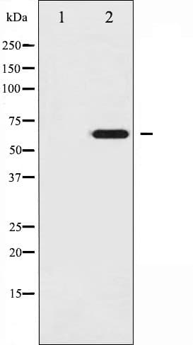EZR / Ezrin Antibody (phospho-Tyr146)
