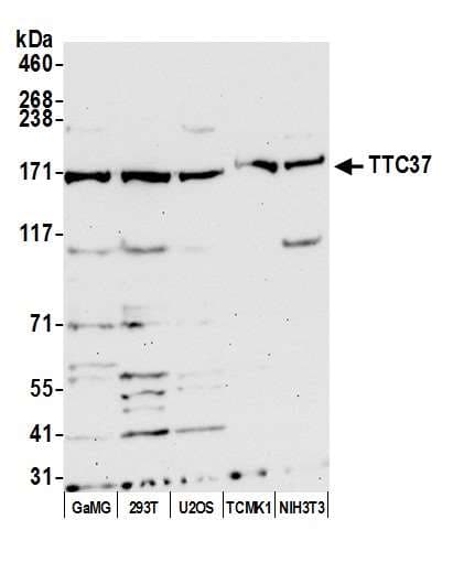 TTC37 Antibody (aa1-50)