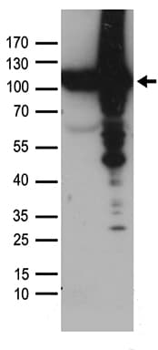 VCP Antibody