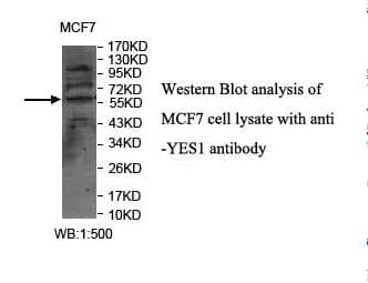 Polyclonal Rabbit anti-Human YES1 / c-Yes Antibody (aa416-538, IHC, WB)