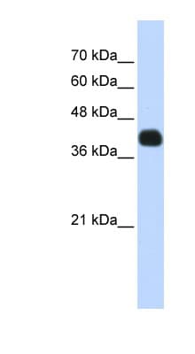 ISL2 / Islet 2 Antibody (N-Terminus)