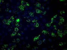 IHC-plus™ FH / Fumarase / MCL Antibody (clone 9G4)