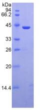 Human MBL2 / Mannose Binding Protein (Recombinant His-GST, N-terminus)