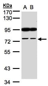 FSD2 Antibody (aa1-215)