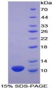 Human CXCL7 / PPBP Protein (Recombinant His, N-Terminal)