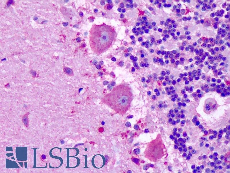IHC-plus™ MRGPRX3 / MRGX3 Antibody (Extracellular Domain)