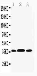 Polyclonal Rabbit anti-Human MAP2K6 / MEK6 / MKK6 Antibody (aa7-23, WB)