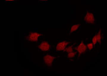 Polyclonal Rabbit anti-Human PAK1 Antibody (phospho-Thr212, IHC, IF, WB)