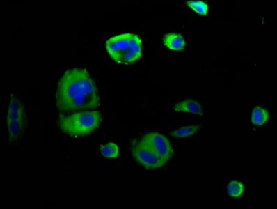 Polyclonal Rabbit anti-Human SEMA4D / Semaphorin 4D / CD100 Antibody (IF)