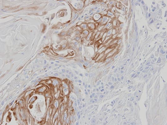 ZPBP / SP38 Antibody (aa29-275)