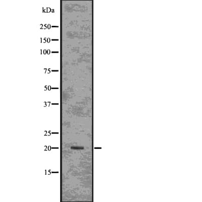 Polyclonal Rabbit anti-Human ARF1 Antibody (WB)