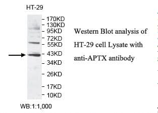 Aprataxin / APTX Antibody (aa13-254)