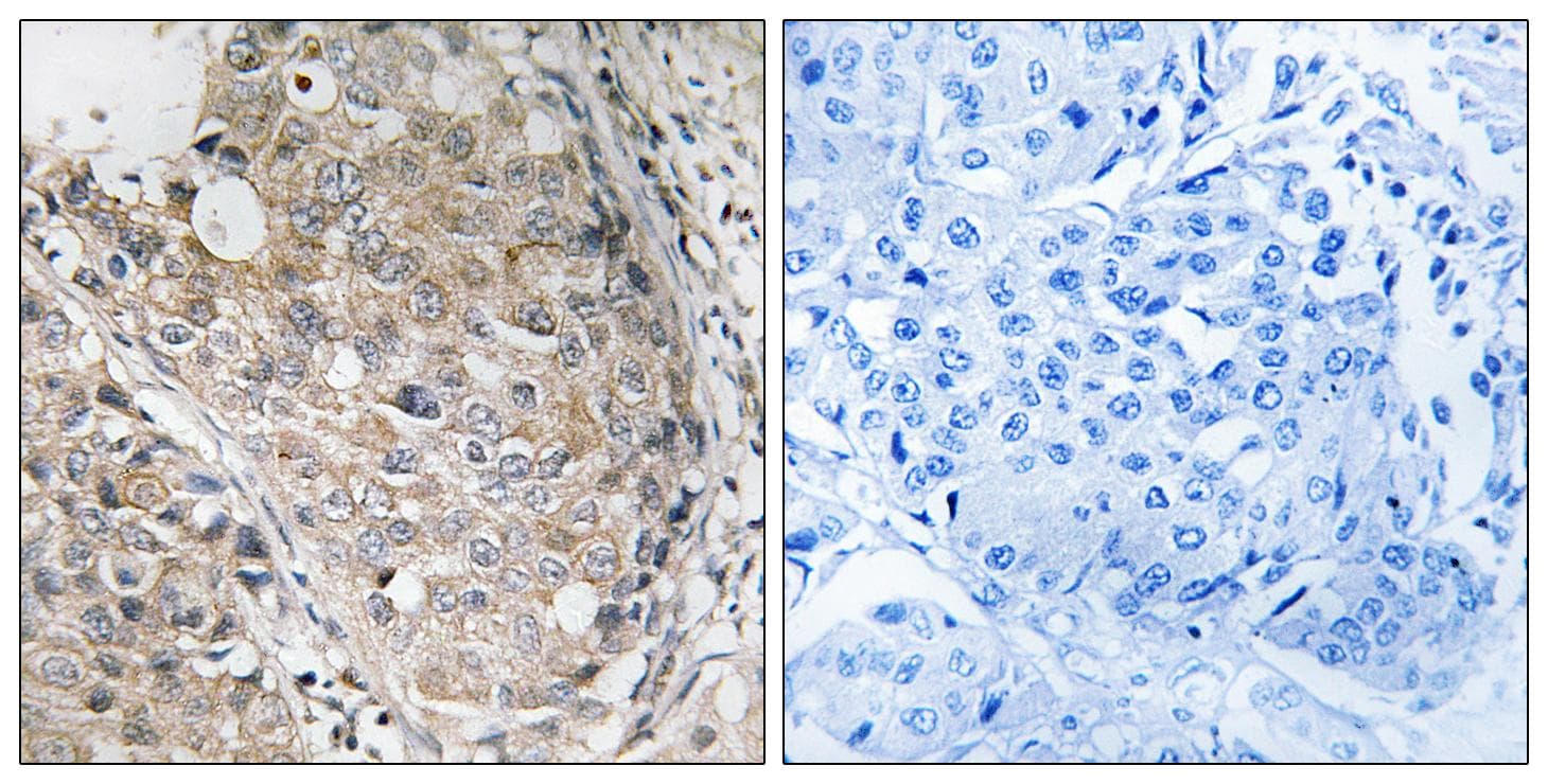 MKP1 + MKP2 Antibody (p296/318)