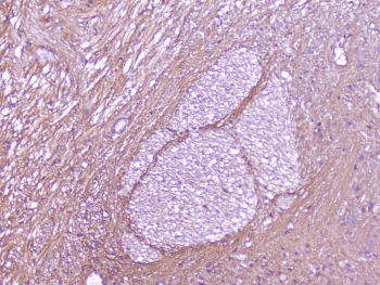 Polyclonal Rabbit anti-Human SNAP25 Antibody (IHC, WB)