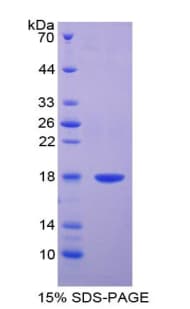 Bovine Adiponectin Protein (Recombinant His)