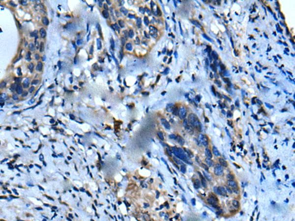 UFC1 Antibody