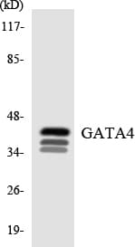 Polyclonal Rabbit anti-Human GATA4 Antibody (aa257-306, WB)