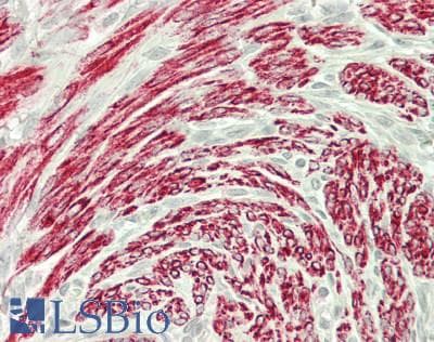 IHC-plus™ DES / Desmin Antibody (clone D33)