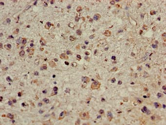 Polyclonal Rabbit anti-Human CDYL Antibody (IHC)