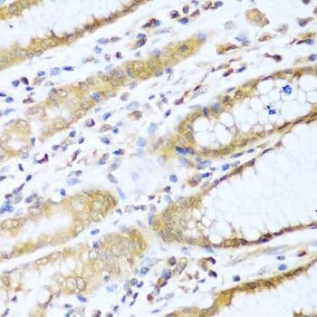 Polyclonal Rabbit anti-Human UBE2L3 / UBCH7 Antibody (IHC, WB)