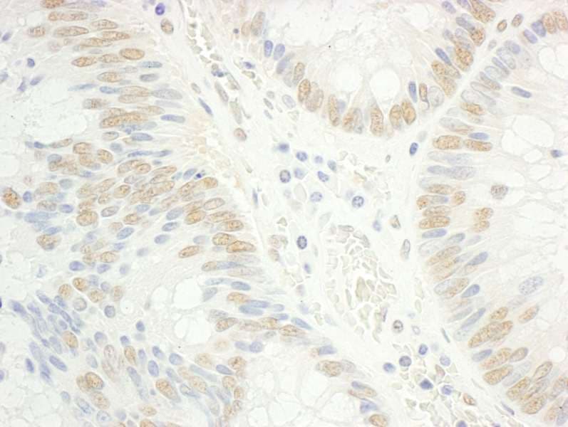RAP74 / GTF2F1 Antibody (aa250-300)