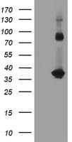 SNAI2 / SLUG Antibody (clone OTI2B11)