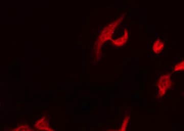 Polyclonal Rabbit anti-Human DOK1 Antibody (phospho-Tyr362, IF, WB)