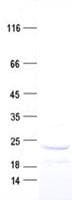 Human IL17B Protein (Recombinant His, N-Terminal)