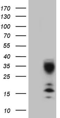 C21orf62 Antibody (clone OTI5B5)