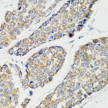 IKBKG / NEMO / IKK Gamma Antibody