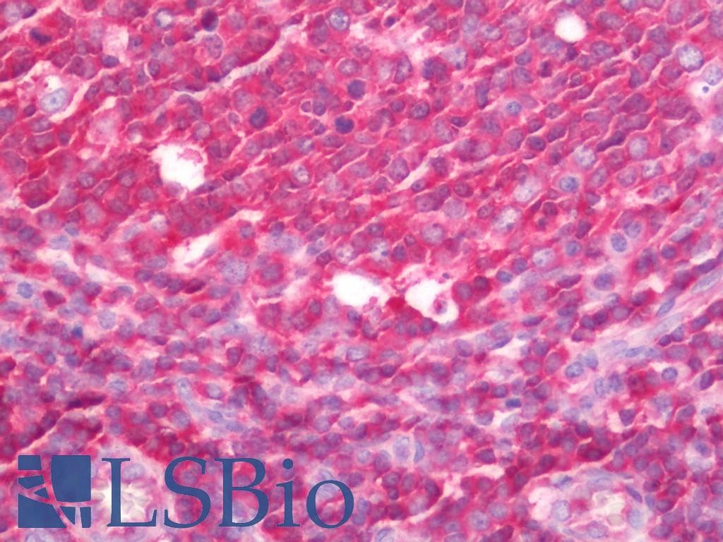 IHC-plus™ CASP8 / Caspase 8 Antibody (aa313-362)