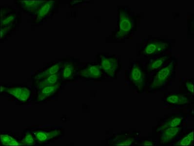 POLL / DNA Polymerase Lambda Antibody