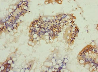 Polyclonal Rabbit anti-Human NRN1L Antibody
