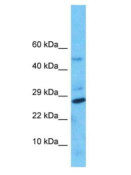 NUDT8 Antibody (aa65-114)