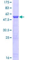 Human PSMB5 Protein (Recombinant GST)