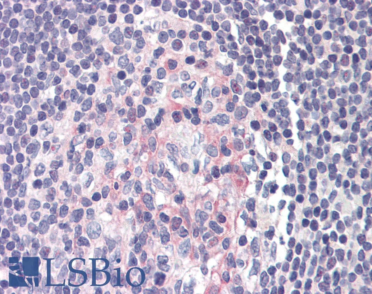 IHC-plus™ Polyclonal Rabbit anti-Human NFKBIB / IKB Beta / IKBB Antibody (C-Terminus, IHC, WB)