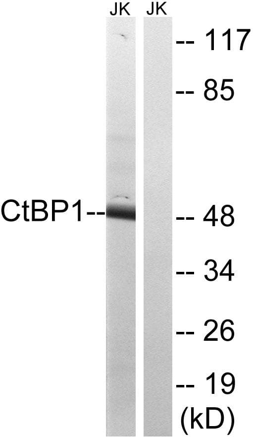 Polyclonal Rabbit anti-Human CTBP1 / CTBP Antibody (p422, IHC, WB)