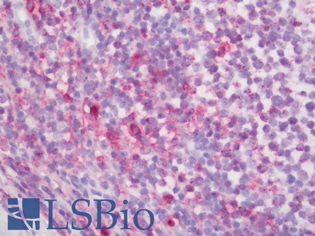 IHC-plus™ CYBA / p22phox Antibody
