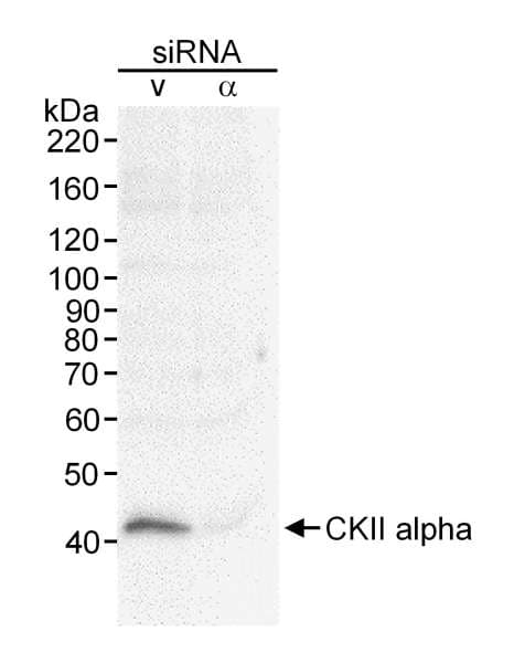 CSNK2A1 Antibody (aa1-50)