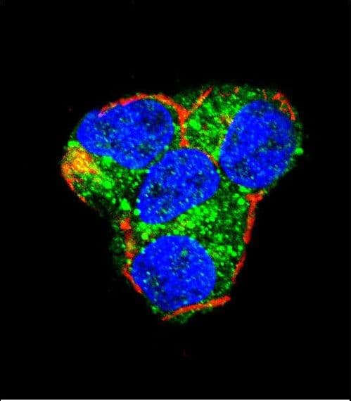 AKT2 Antibody (aa93-123)