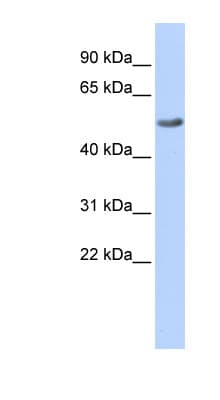 Polyclonal Rabbit anti-Human RGS6 Antibody (N-Terminus, WB)