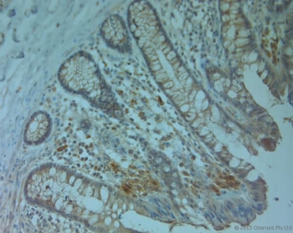 ABCC6 / MRP6 Antibody (aa825-875)