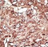 Polyclonal Rabbit anti-Human PRMT7 Antibody (aa1-30, IHC, WB)