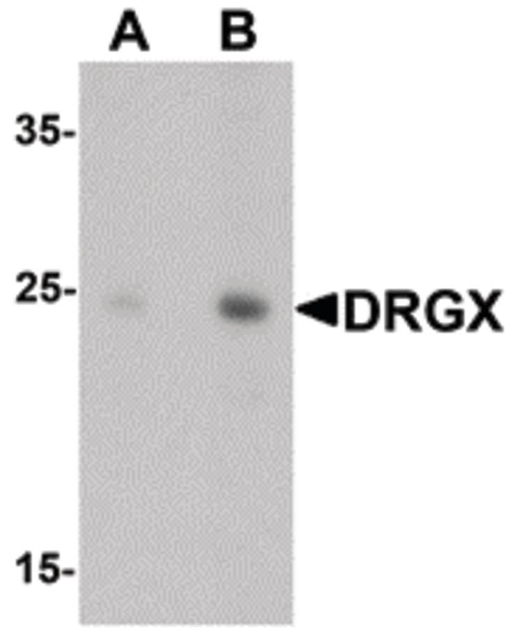 IHC-plus™ DRGX Antibody