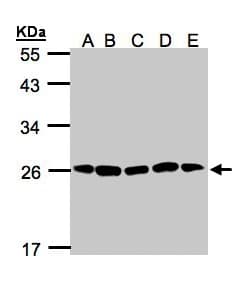PSMA2 Antibody (aa1-234)