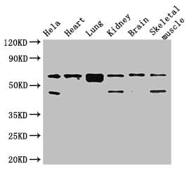PRKAA2 / AMPK Alpha 2 Antibody