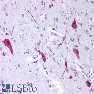 PathPlus™ GRM4 / MGLUR4 Antibody (N-Terminus)